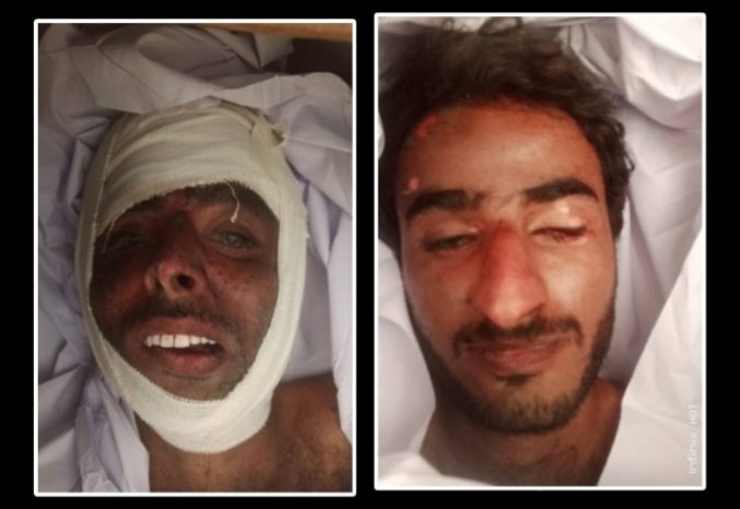 شهادت دو سرمچار بلوچ در نتیجه درگیری با ارتش پاکستان در کوه های مزن بند