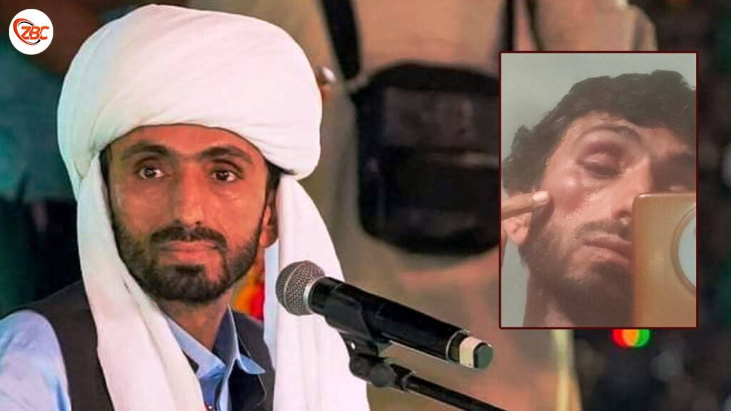 جاپر آباد ءَ بلوچی زبان ءِ گشندہ وھاب بگٹی آزار دیگ بوتگ